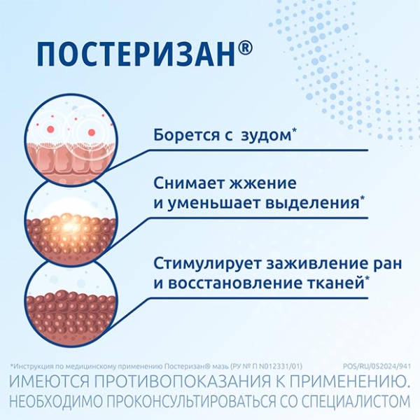 Зуд в заднем проходе ᐈ анальный зуд в попе у женщин и мужчин | Добрый прогноз